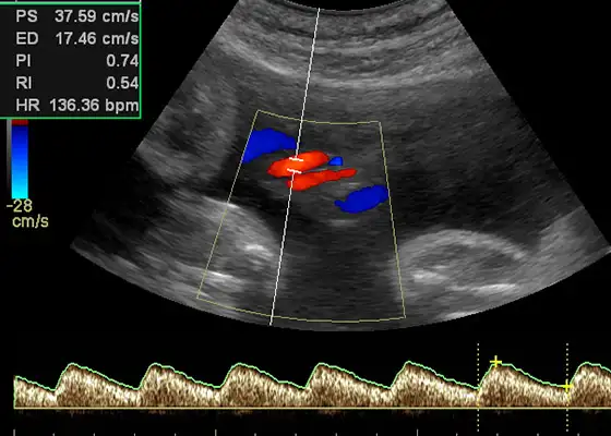 Farbdopplersonographie in der Praxis